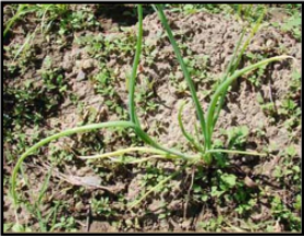 Magnesium deficiency