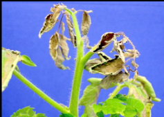 CALCIUM Deficiency